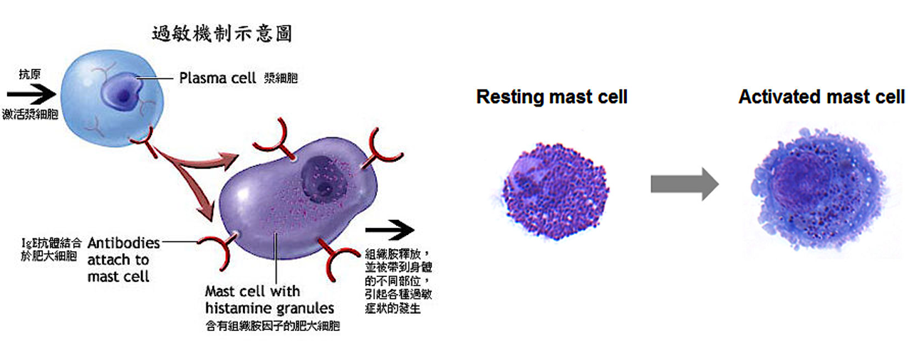 allergy overview mast cell activation